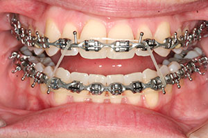 Ortho Care Orthodontics