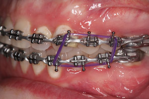 Ortho Care Orthodontics