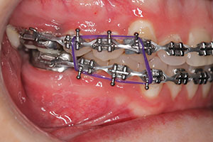 Ortho Care Orthodontics