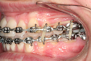 Ortho Care Orthodontics