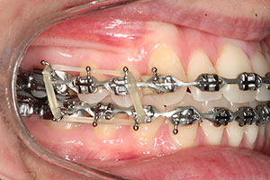 Ortho Care Orthodontics