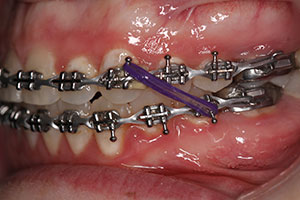 Ortho Care Orthodontics