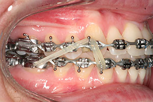 Ortho Care Orthodontics