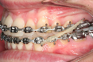 Ortho Care Orthodontics