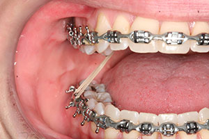 Ortho Care Orthodontics