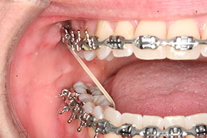 Ortho Care Orthodontics