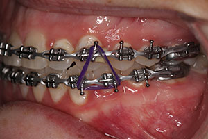 Ortho Care Orthodontics