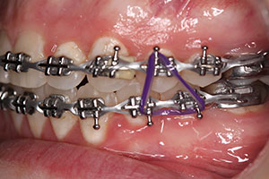 Ortho Care Orthodontics